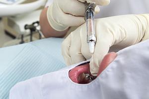 豊平区で大腸内視鏡検査を受けられる病院