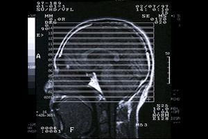 安心して子どもを預けられる！草加市で評判の小児科クリニック徹底ガイド