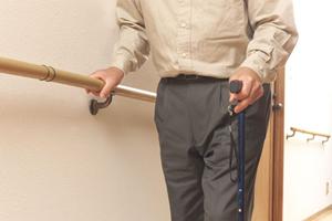 美しい表情を作るセラミッククラウン